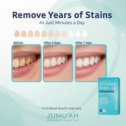 Jumu’ah Teeth Whitening Strips - 7 Treatments - 14 Strips